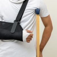 ManBrokenArm ManBrokenArm